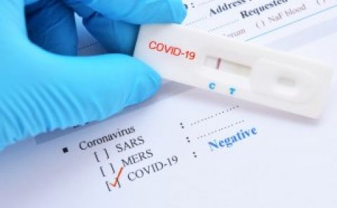 ~COMMUNIQUE DE PRESSE SCHAERBEEK : UN CENTRE DE TESTING COVID-19 OUVRE CE JEUDI / SCHAERBEEK: BİR COVID-19 TEST MERKEZİ BU PERŞEMBE AÇILIYOR